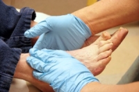 Treating Diabetic Foot Ulcers