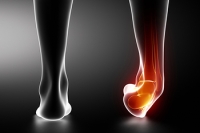 When Ankle Sprains Do Not Heal Properly 