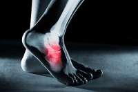Stress Fractures May Affect the Ankles